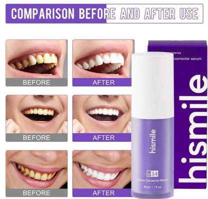 HiSmile Serum for Teeth Whitening